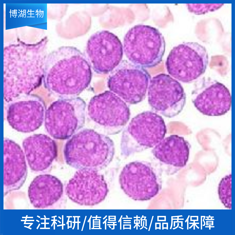 乳腺癌阿霉素耐药细胞株