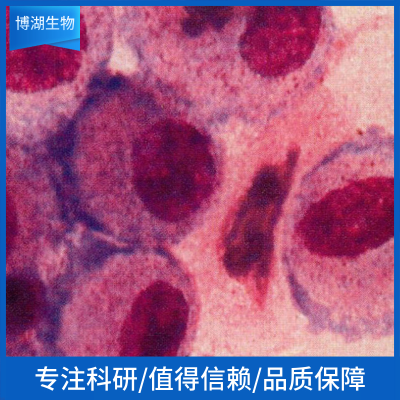 HCC-LM3人高转移肝癌细胞	HCC-LM3