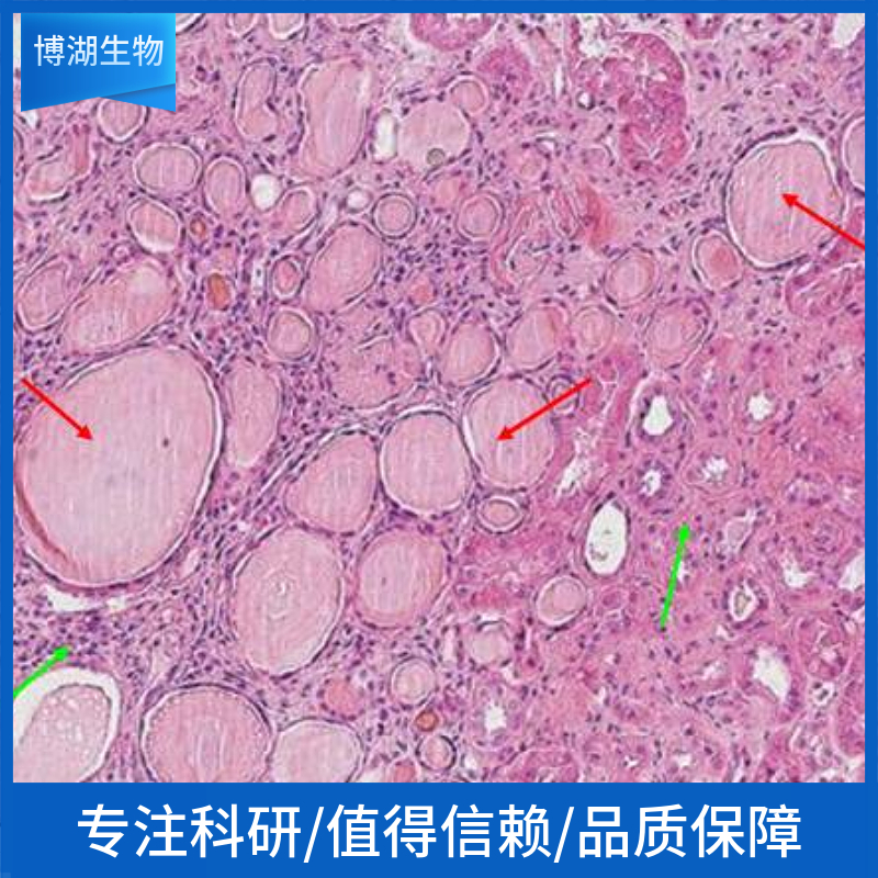 hct-15人结肠癌细胞	hct-15