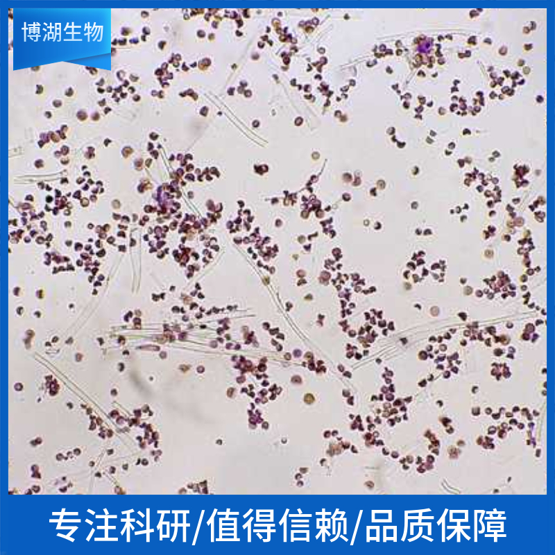 hccc-9810人胆管细胞型肝癌细胞	hccc-9810