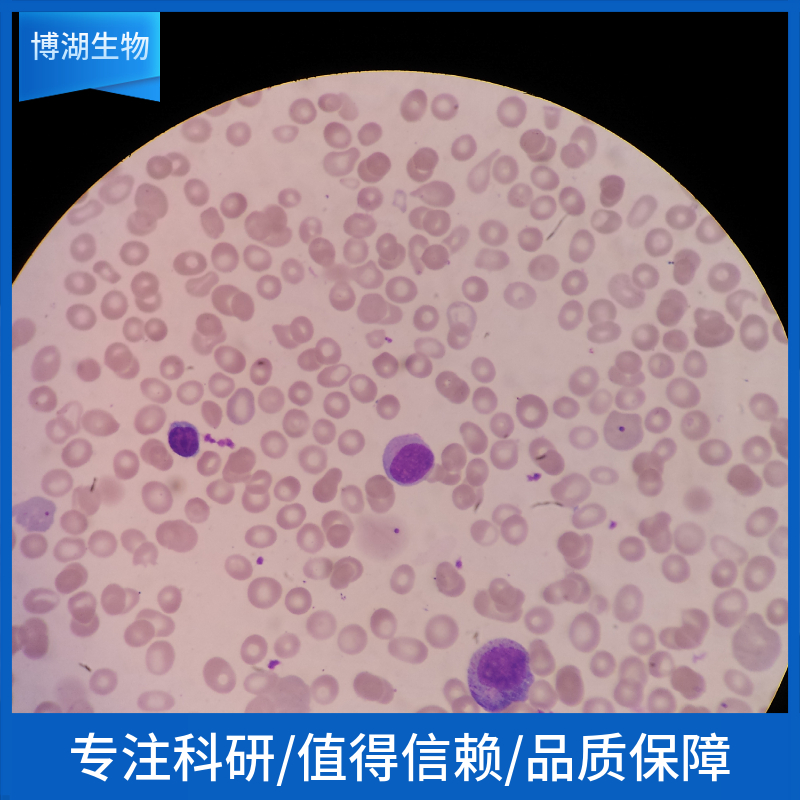 HCT-8人结直肠癌癌细胞	HCT-8