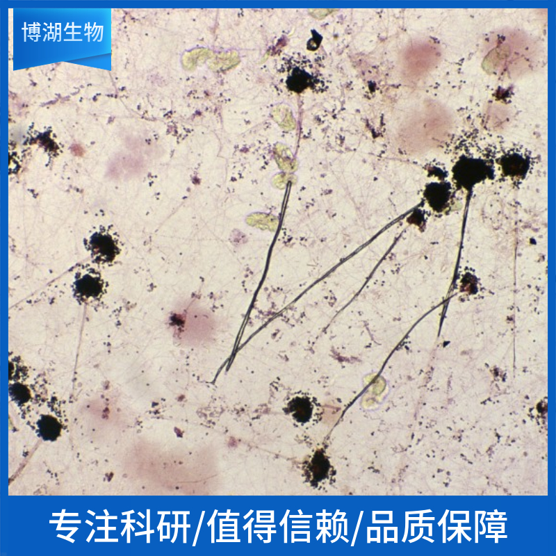 HCC-94人子宫鳞癌细胞(高分化) 	HCC-94
