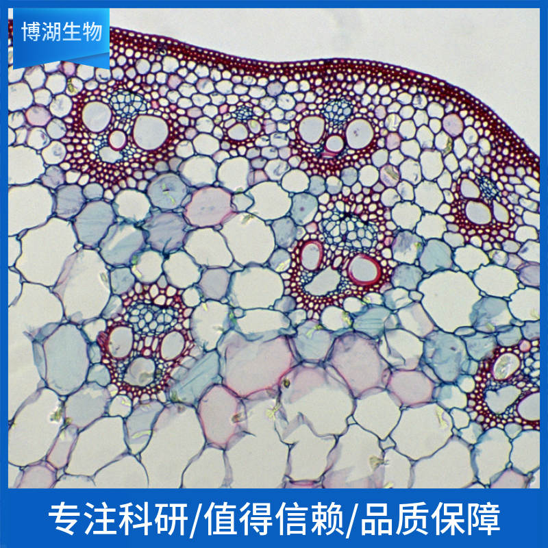HEC-1-A人子宫内膜腺癌细胞	HEC-1-A